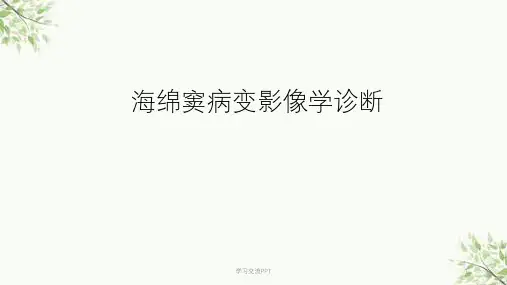 海绵窦病变影像学诊断课件