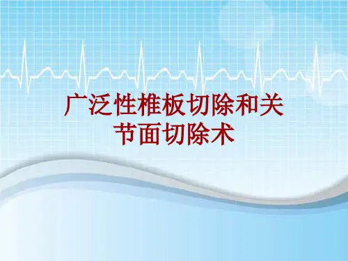 手术讲解模板：广泛性椎板切除和关节面切除术