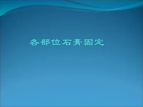 石膏固定