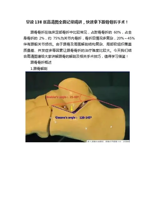 早读138张高清图全面记录精讲，快速拿下跟骨骨折手术！