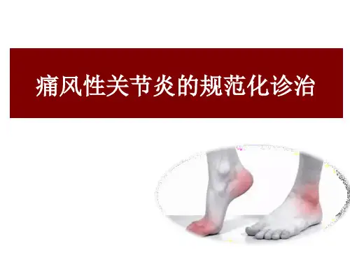 痛风性关节炎的规范化诊治 PPT课件