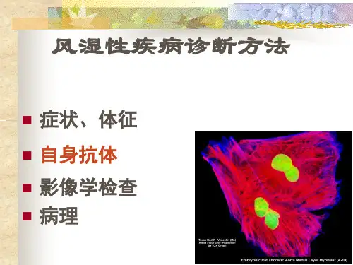 风湿性疾病中自身抗体的意义ppt课件.ppt
