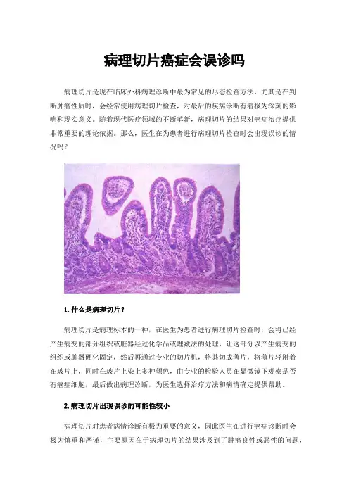 病理切片癌症会误诊吗