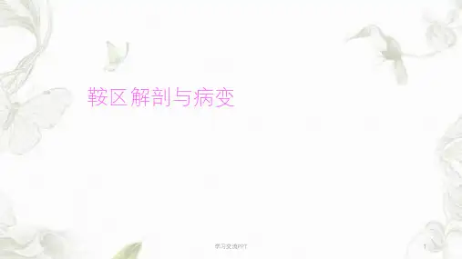 鞍区解剖与病变ppt课件