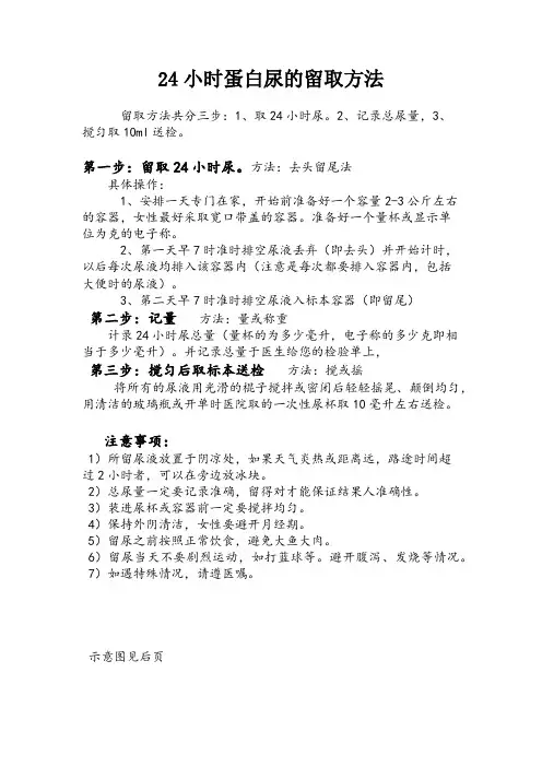24小时蛋白尿的留取方法
