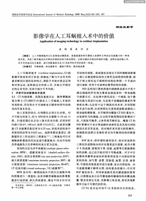 影像学在人工耳蜗植入术中的价值