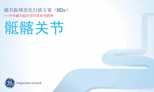 GE-1.5T-MR-骶髂关节规范化扫描方案