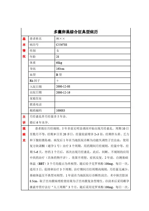 多囊卵巢综合征典型病历