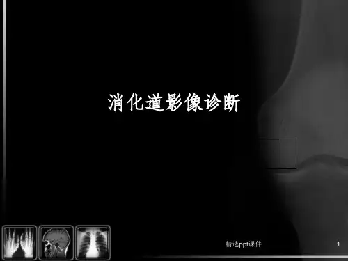 消化道影像诊断