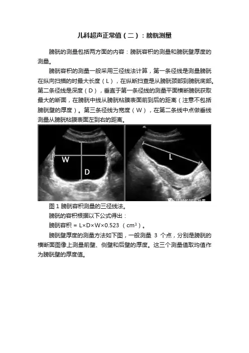 儿科超声正常值（二）：膀胱测量