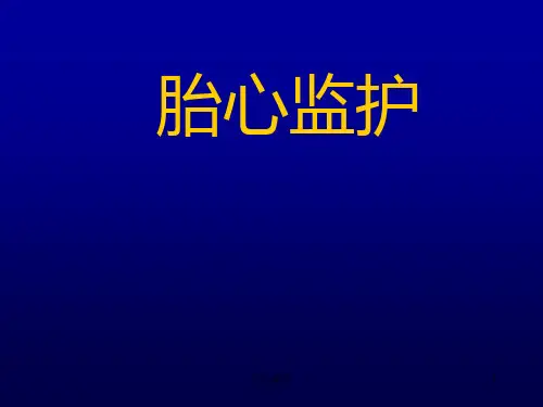 胎心监护：胎心监护图形基本知识、产前胎心率试验(业界深析)