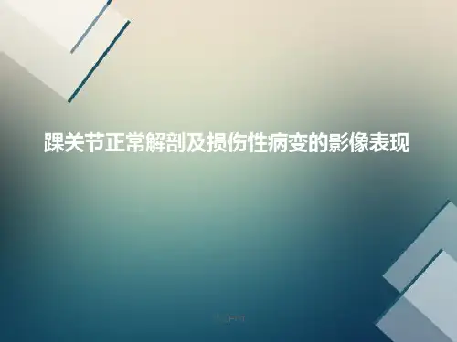 踝关节正常解剖和损伤性病变的影像表现