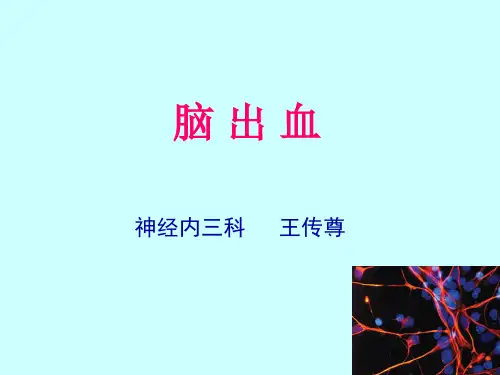 脑出血.