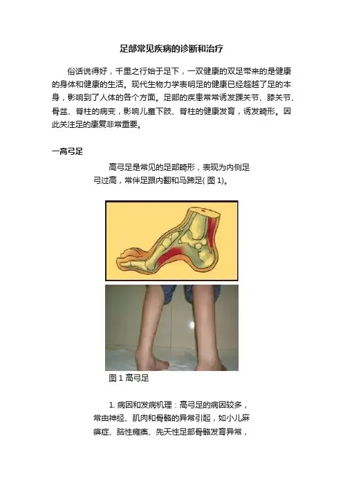 足部常见疾病的诊断和治疗