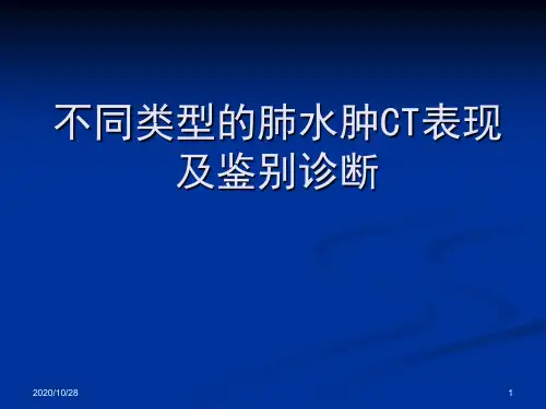 不同类型的肺水肿CT表现及鉴别诊断 ppt课件