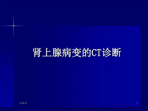 肾上腺病变的CT诊断
