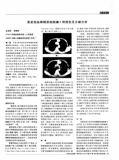 原发性纵隔精原细胞瘤6例报告及文献分析