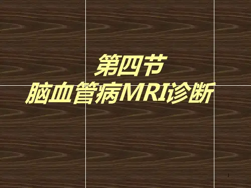 脑血管病MRPPT课件