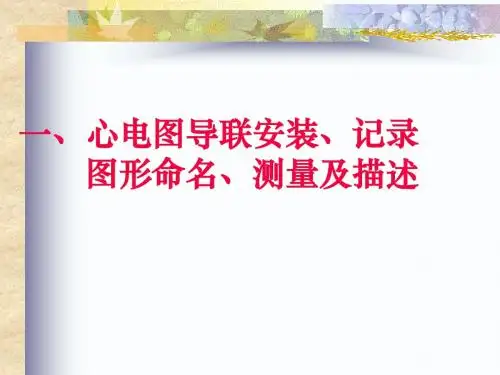 常见心电图诊断