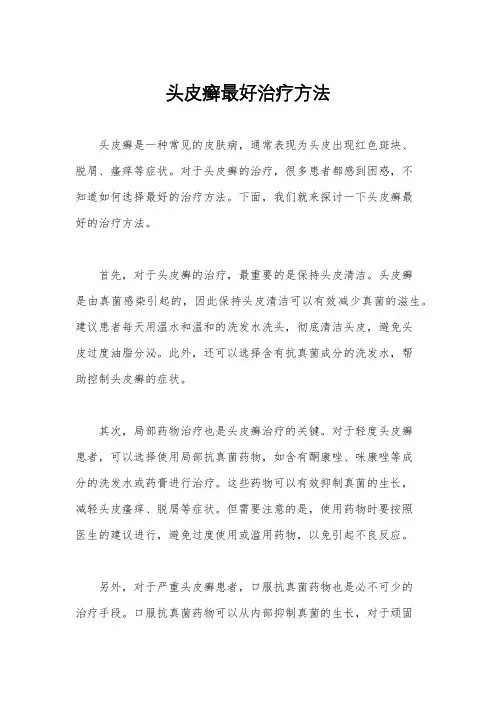 头皮癣最好治疗方法