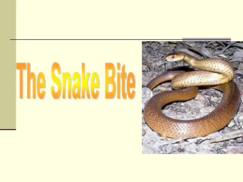 Unit 3 The Snake Bite(被蛇咬)(综合英语教程2第三单元)解析