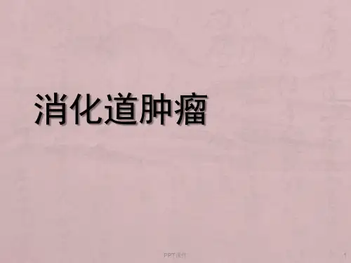 消化道肿瘤  ppt课件
