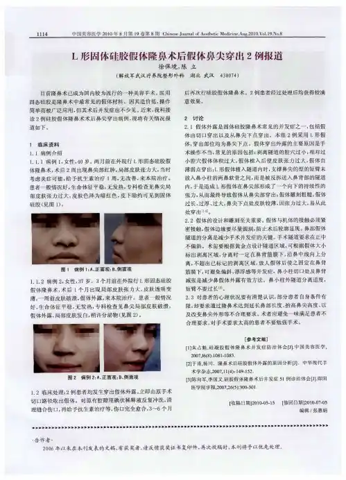 L形固体硅胶假体隆鼻术后假体鼻尖穿出2例报道