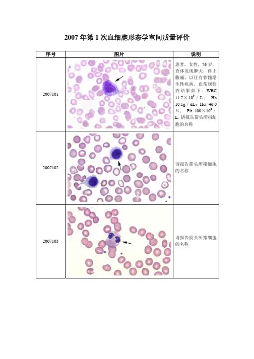2007-2014年卫生部临检中心血细胞形态学检查室间质量评价(及答案)