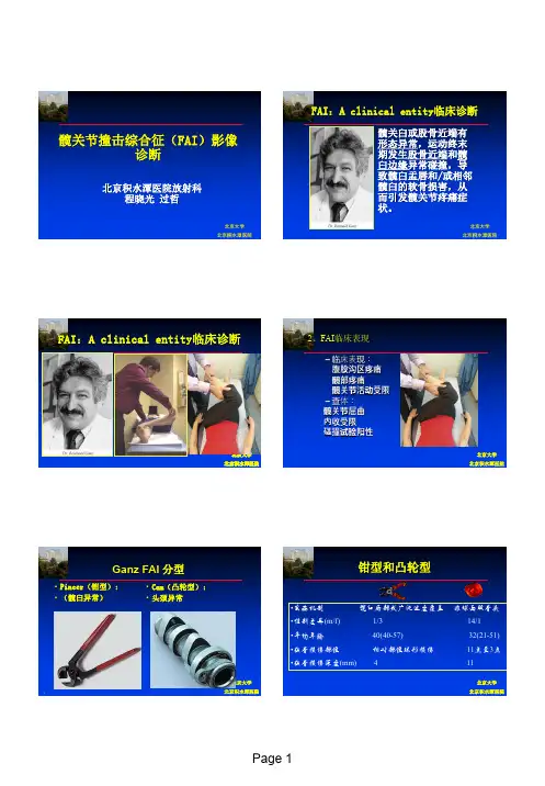 程晓光--髋关节撞击综合征的影像诊断