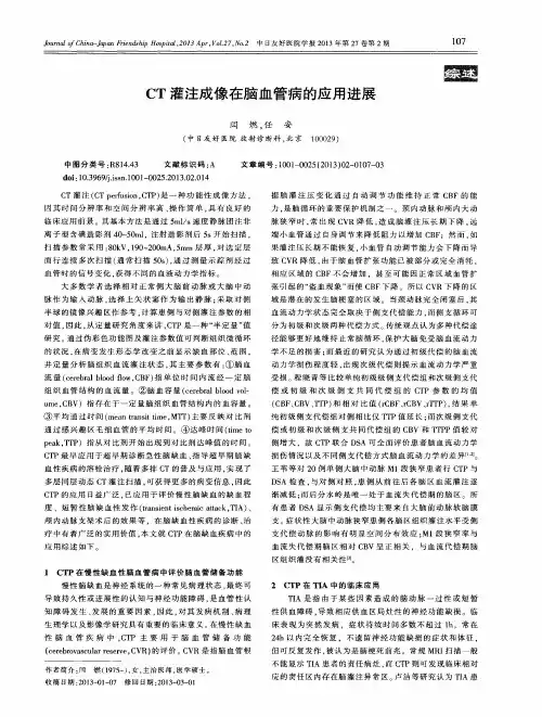 CT灌注成像在脑血管病的应用进展