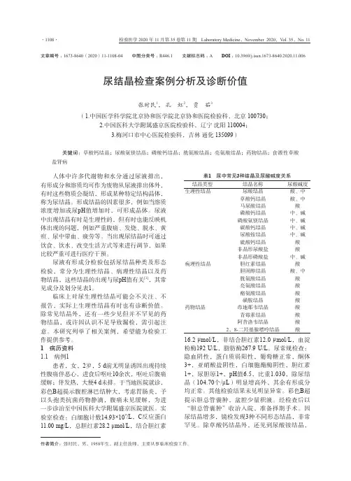 尿结晶检查案例分析及诊断价值
