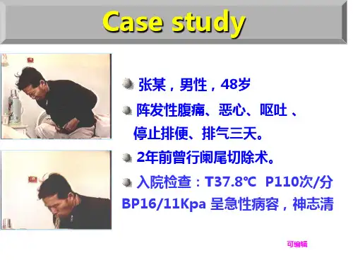 外科肠梗阻PPT课件