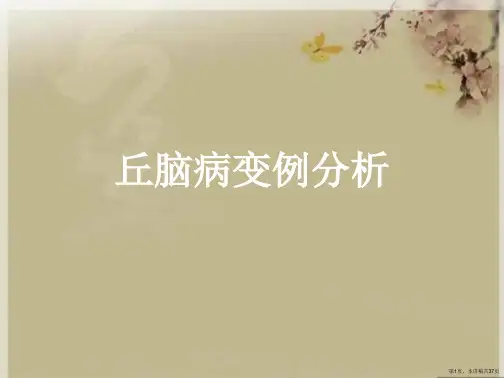 丘脑病变例分析
