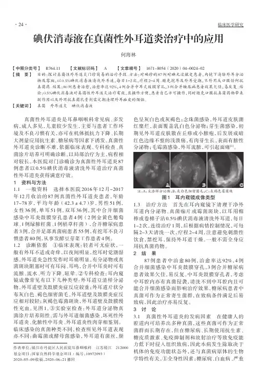碘伏消毒液在真菌性外耳道炎治疗中的应用