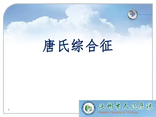 唐氏综合征ppt课件