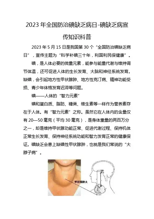2023年全国防治碘缺乏病日-碘缺乏病宣传知识科普