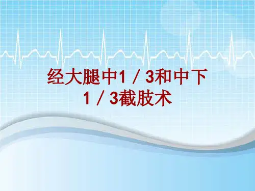 手术讲解模板：经大腿中1／3和中下1／3截肢术