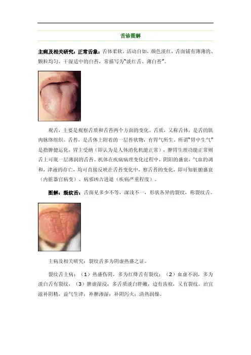 中医舌诊图解