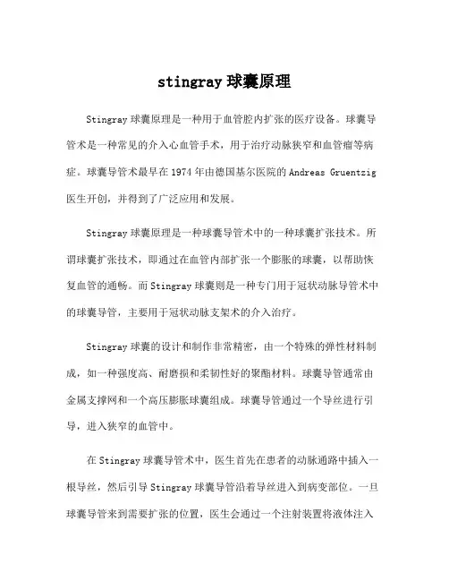 stingray球囊原理