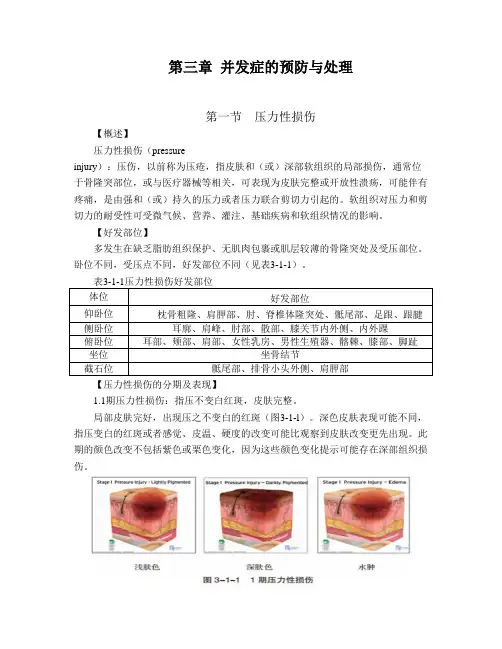 并发症的预防与处理