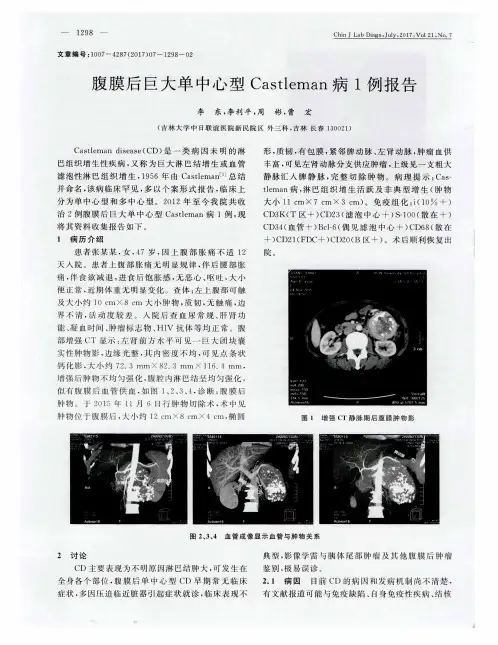 腹膜后巨大单中心型Castleman病1例报告