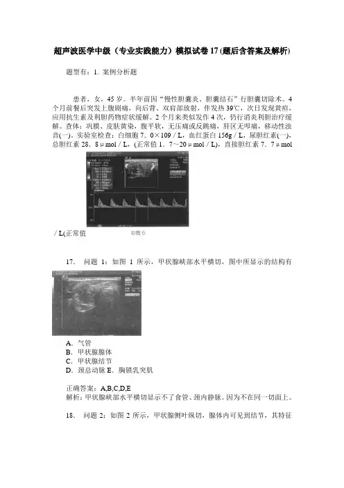 超声波医学中级(专业实践能力)模拟试卷17(题后含答案及解析)