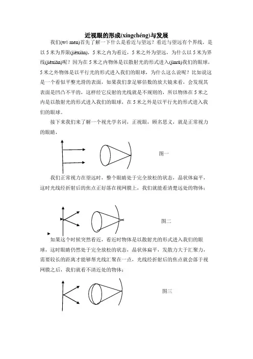 近视眼的形成与发展