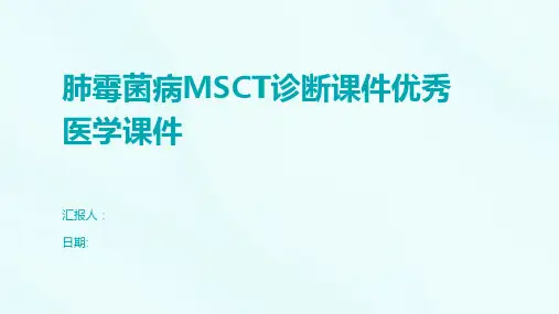 肺霉菌病MSCT诊断课件优秀医学课件