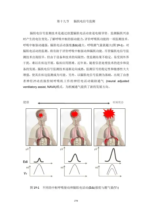 19-膈肌电活动信号监测技术
