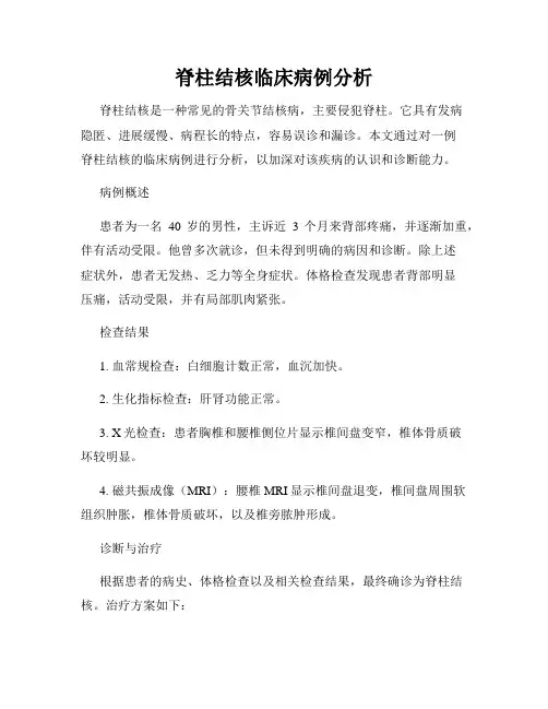 脊柱结核临床病例分析
