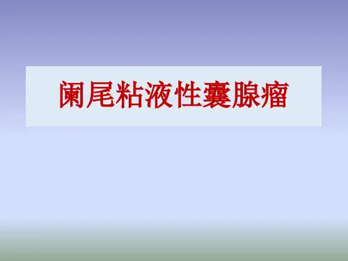 阑尾粘液性囊腺瘤影像诊断与鉴别