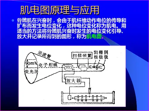 3-肌电图