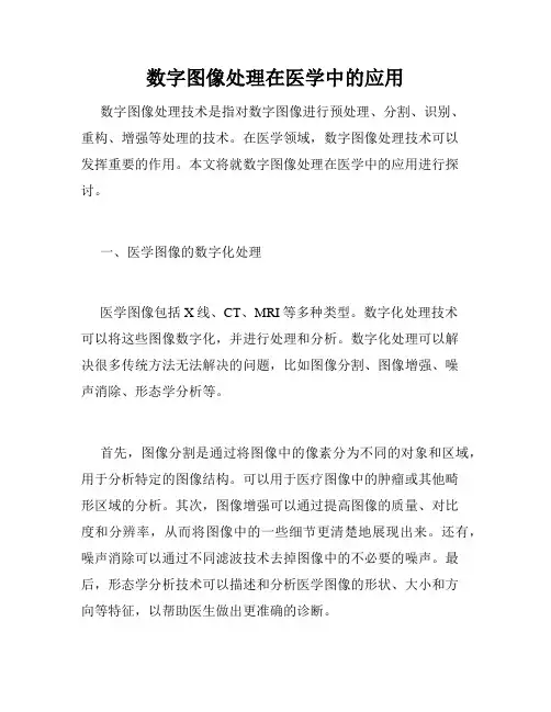 数字图像处理在医学中的应用