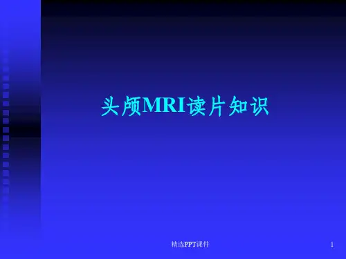 头颅MRI入门必修之读片知识ppt课件